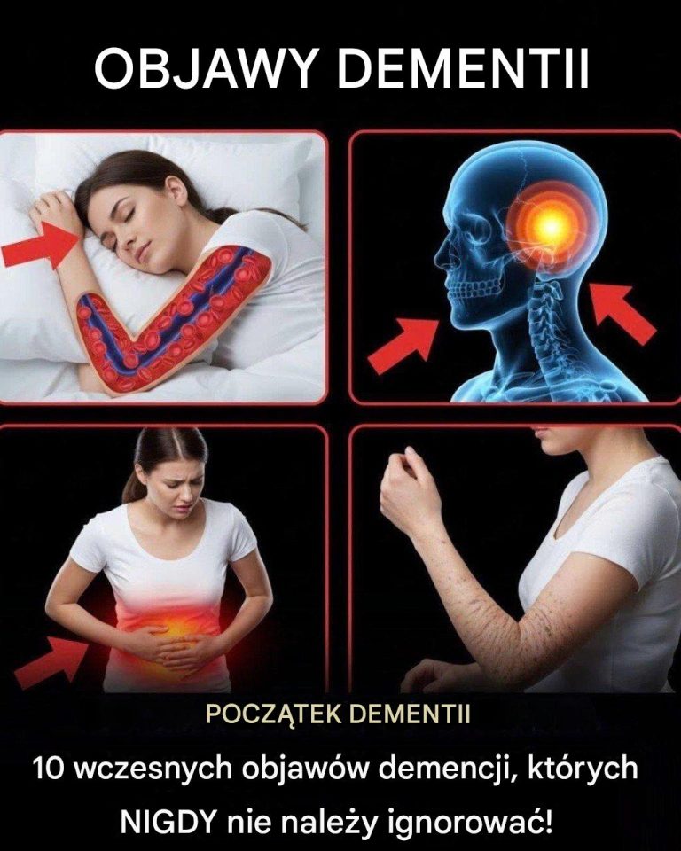 10 wczesnych objawów demencji, których NIGDY nie należy ignorować!…
