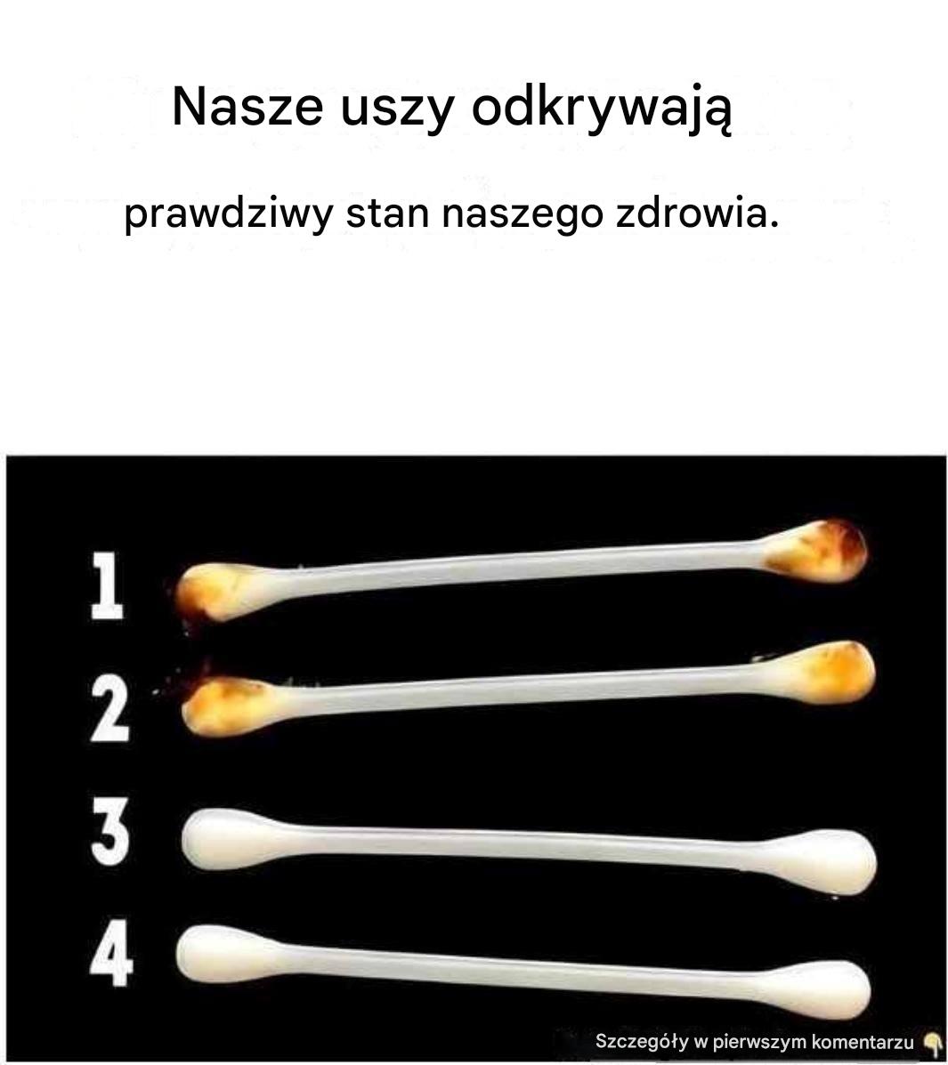 Nasze uszy pokazują prawdziwy stan naszego zdrowia.